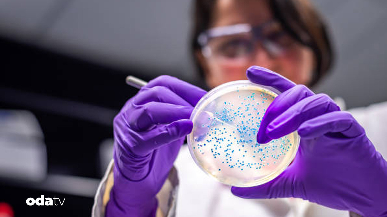 ABD’de 10 eyalette salmonella alarmı: 7 kişi hastanelik abdde 10 eyalette salmonella alarmi 7 kisi hastanelik ylGFu25i