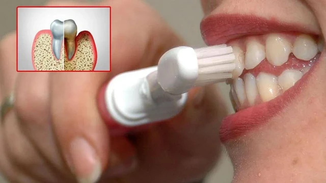 agiz bakterileri kalp krizine yol acabilir QEr4OF95